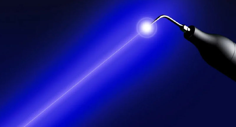 ブルーラジカル治療の特長