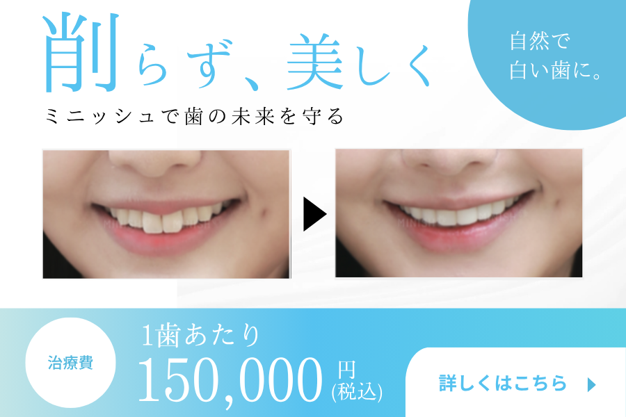 ミニッシュ治療